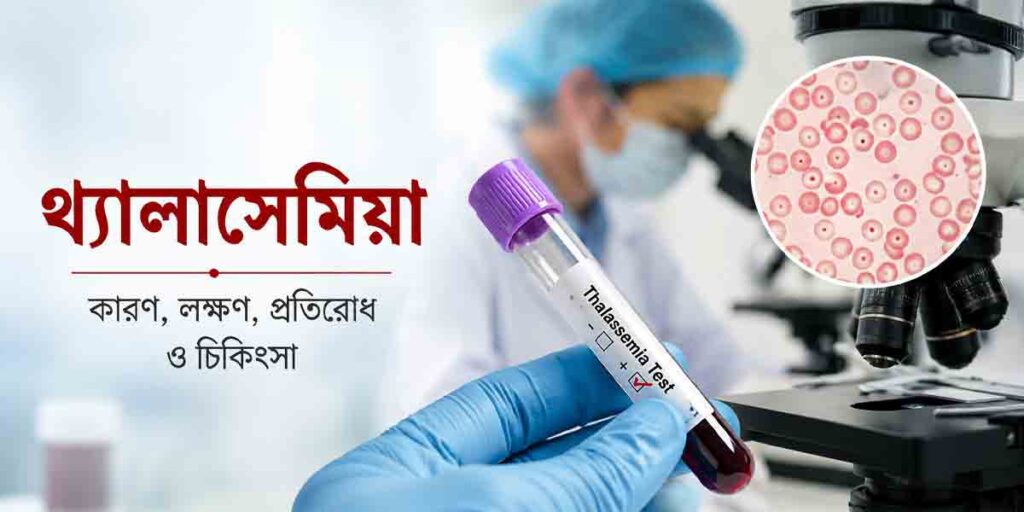 থ্যালাসেমিয়া | কারণ, লক্ষণ, চিকিৎসা ও প্রতিরোধ সম্পর্কে বিস্তারিত জানুন